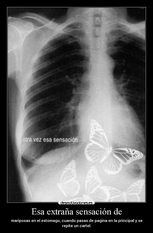 Esa extraña sensación de - mariposas en el estomago, cuando pasas de pagina en la principal y se
repite un cartel.