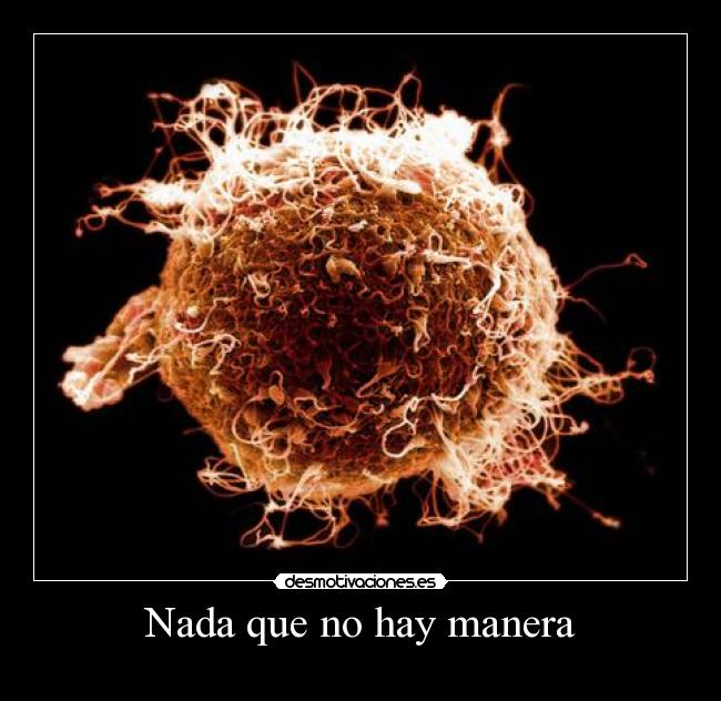 Nada que no hay manera - 