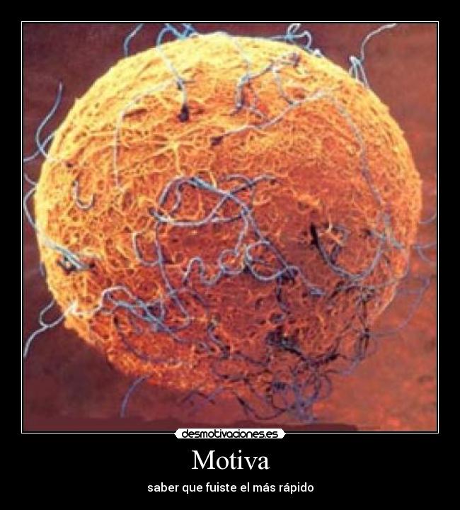 Motiva - 