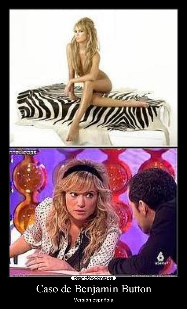 Caso de Benjamin Button -