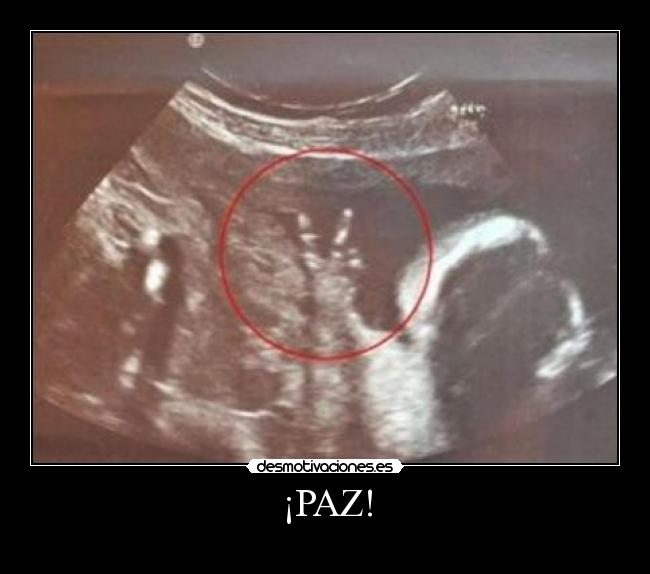 ¡PAZ! - 