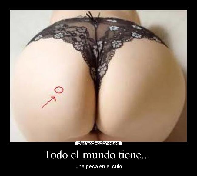 Todo el mundo tiene... - una peca en el culo