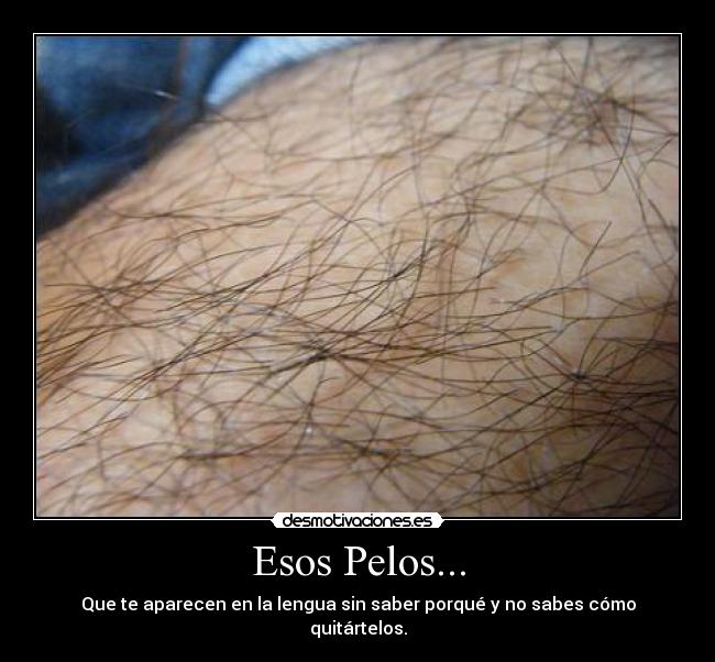 Esos Pelos... - 