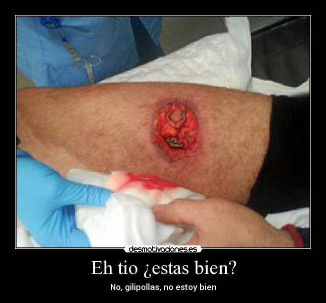 Eh tio ¿estas bien? -