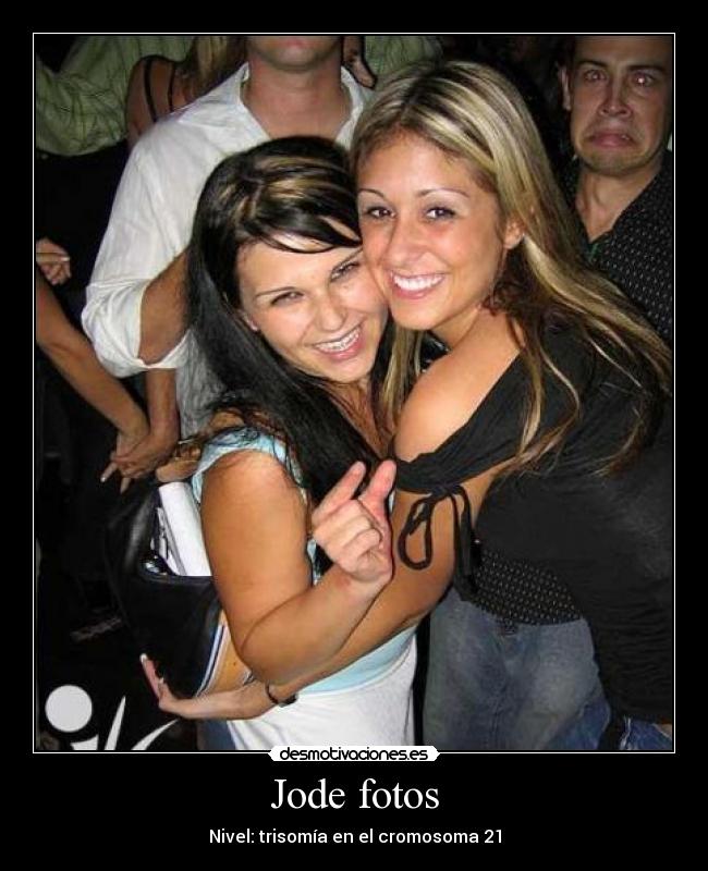 Jode fotos - Nivel: trisomía en el cromosoma 21