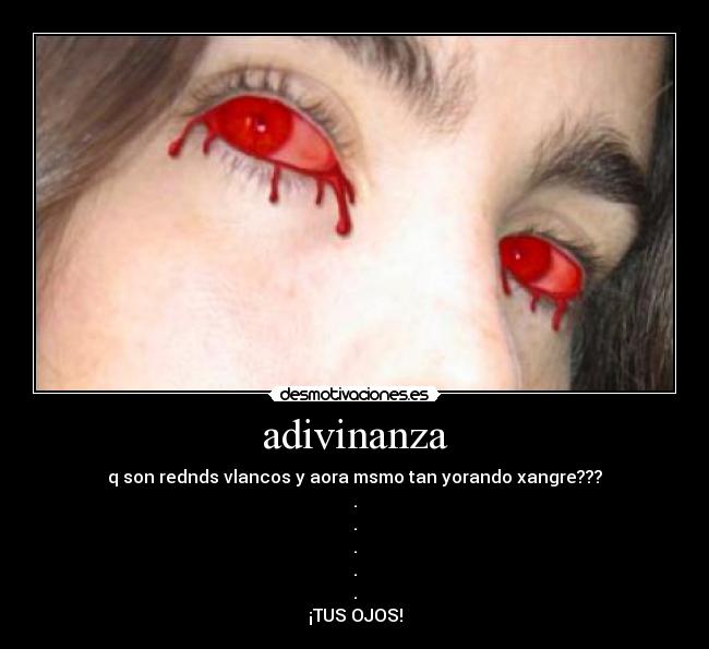 adivinanza - q son rednds vlancos y aora msmo tan yorando xangre???
.
.
.
.
.
¡TUS OJOS!