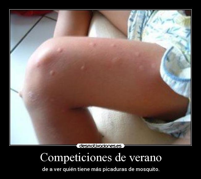 Competiciones de verano - de a ver quién tiene más picaduras de mosquito.