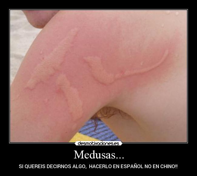 Medusas... - SI QUEREIS DECIRNOS ALGO, HACERLO EN ESPAÑOL NO EN CHINO!!