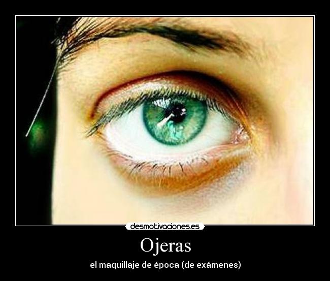 Ojeras -