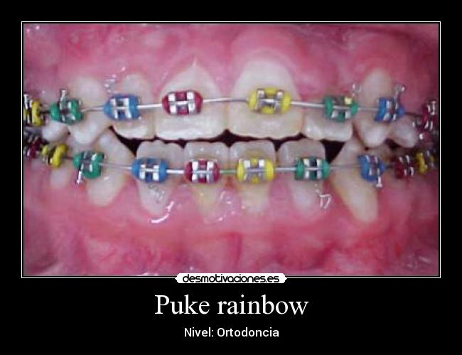 Puke rainbow - 