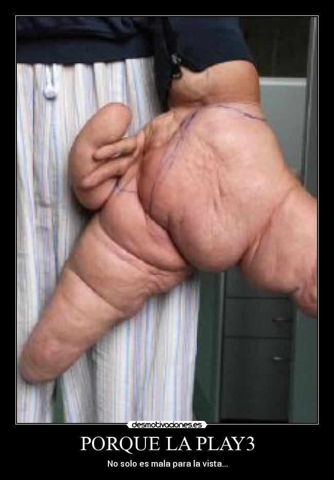 PORQUE LA PLAY3 - No solo es mala para la vista...