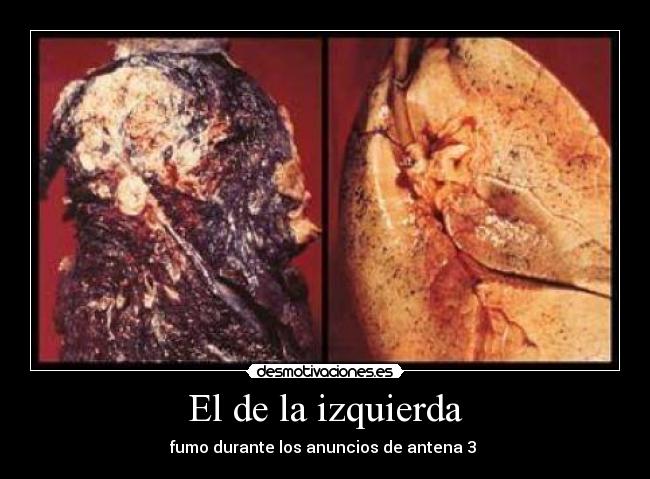 El de la izquierda - 