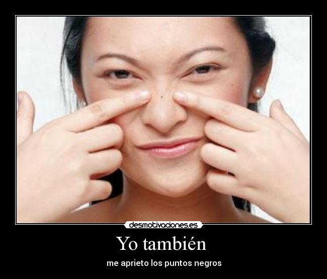 Yo también  - me aprieto los puntos negros