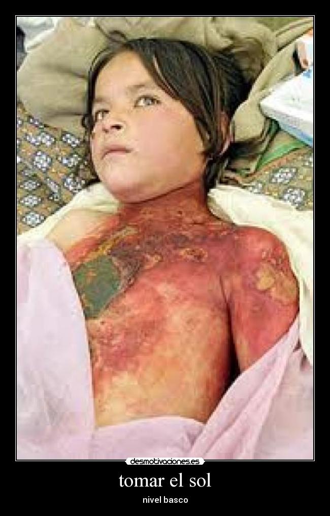 tomar el sol - 