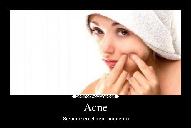 Acne -