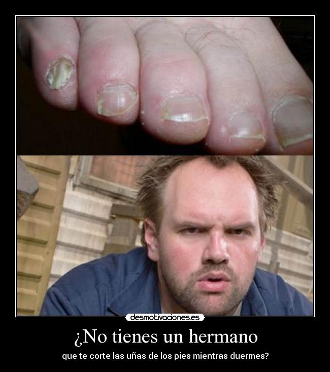 ¿No tienes un hermano - 