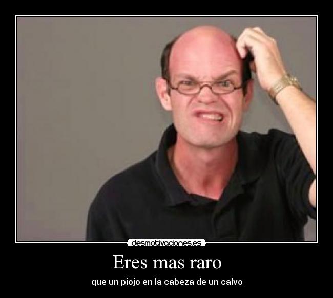 Eres mas raro - que un piojo en la cabeza de un calvo