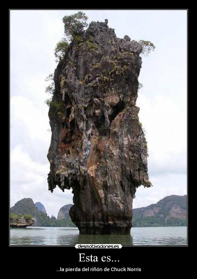 Esta es... - ...la pierda del riñón de Chuck Norris