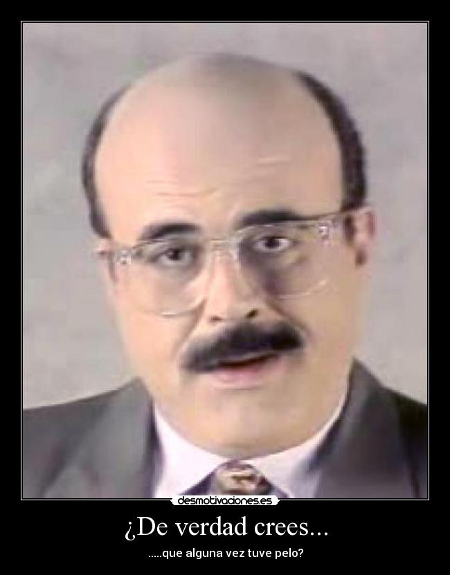 ¿De verdad crees... - .....que alguna vez tuve pelo?