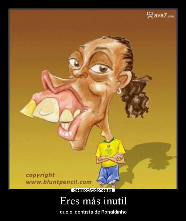 Eres más inutil - que el dentista de Ronaldinho