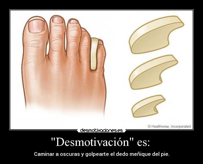 Desmotivación es: - Caminar a oscuras y golpearte el dedo meñique del pie.