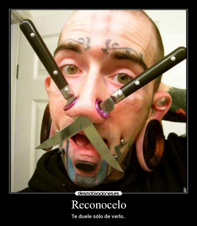 Reconocelo - Te duele sólo de verlo..