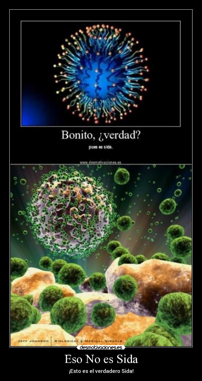 Eso No es Sida - ¡Esto es el verdadero Sida!