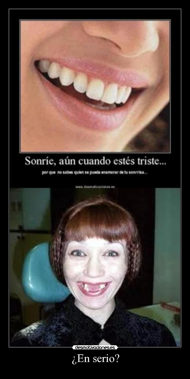 ¿En serio? - 