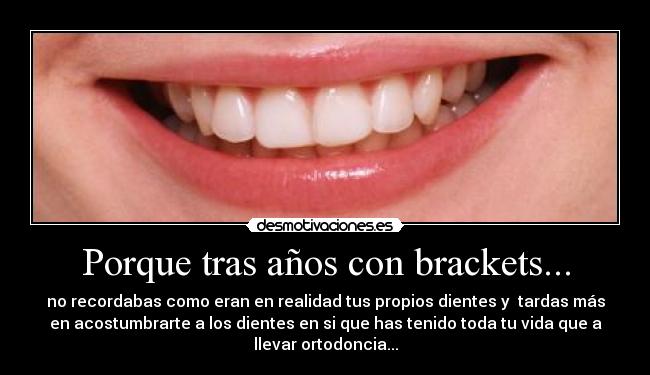 Porque tras años con brackets... -