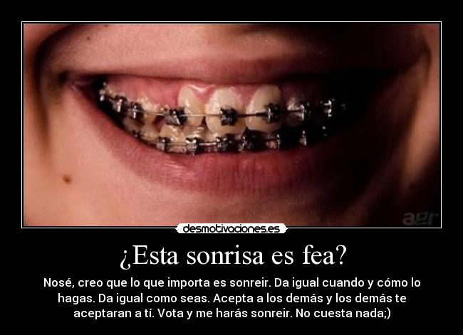 ¿Esta sonrisa es fea? - 