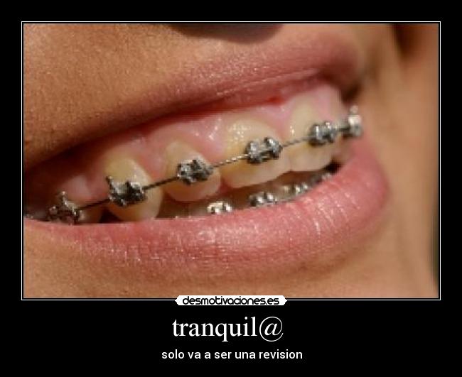 tranquil@ - solo va a ser una revision