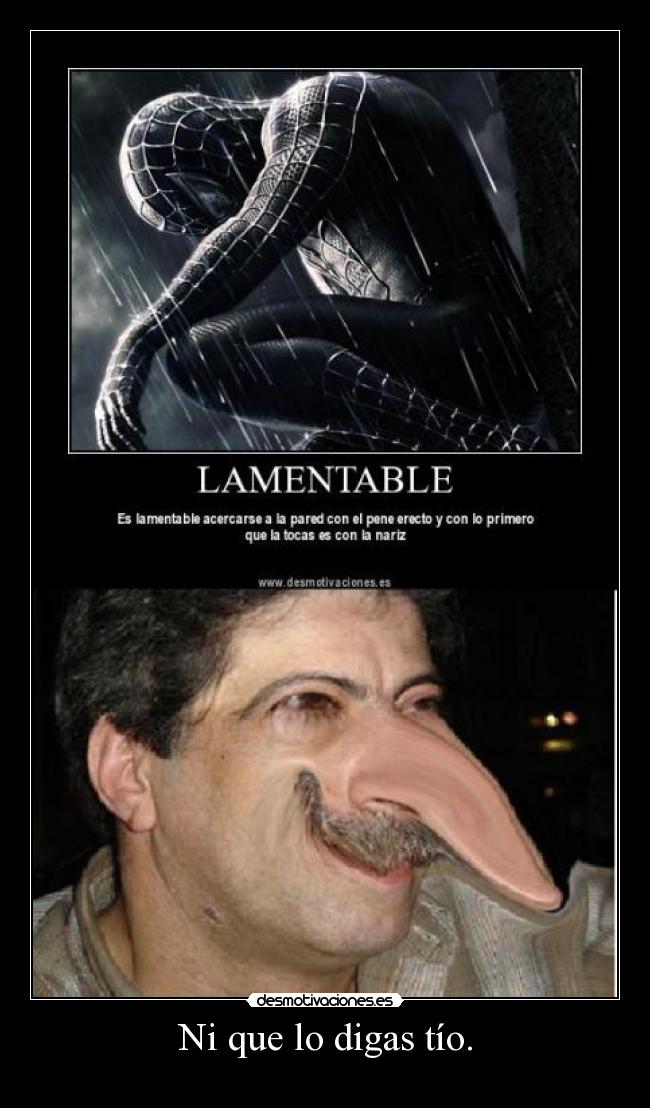 Ni que lo digas tío. - 