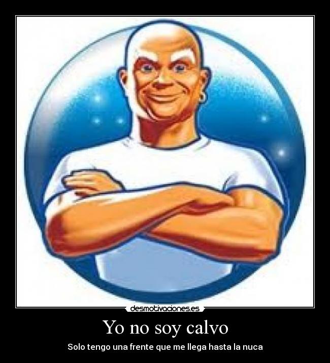 Yo no soy calvo - Solo tengo una frente que me llega hasta la nuca