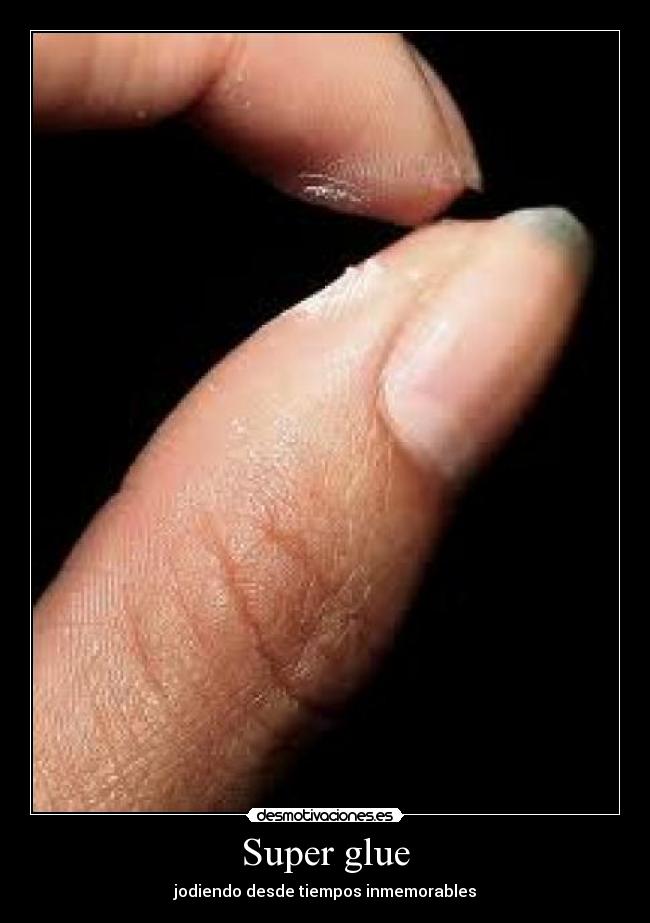 Super glue - jodiendo desde tiempos inmemorables