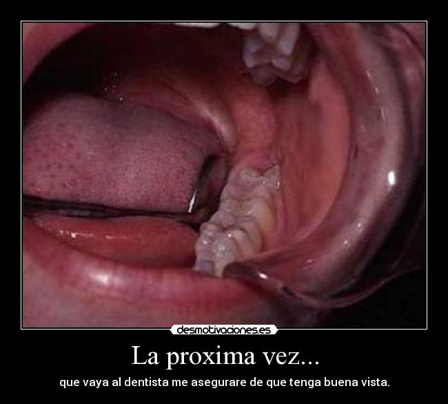 La proxima vez... - que vaya al dentista me asegurare de que tenga buena vista.