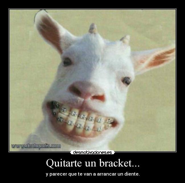 Quitarte un bracket... - y parecer que te van a arrancar un diente.