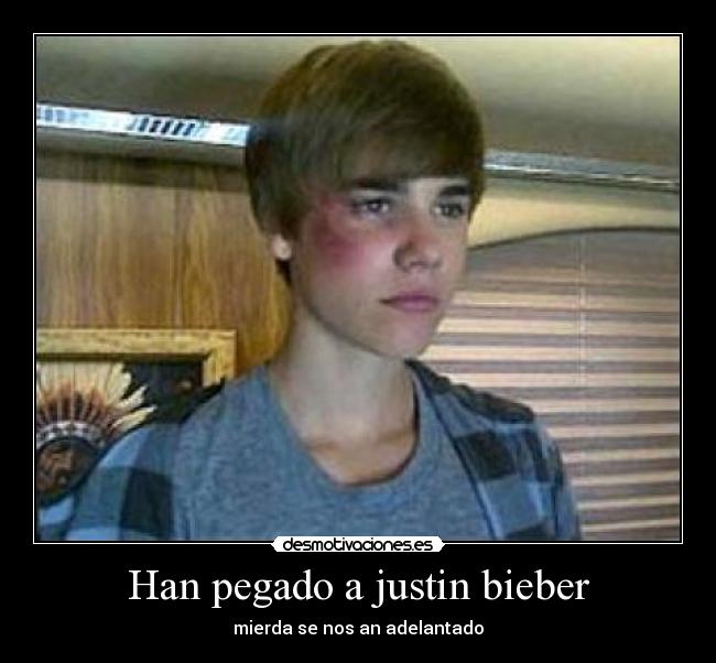Han pegado a justin bieber - 
