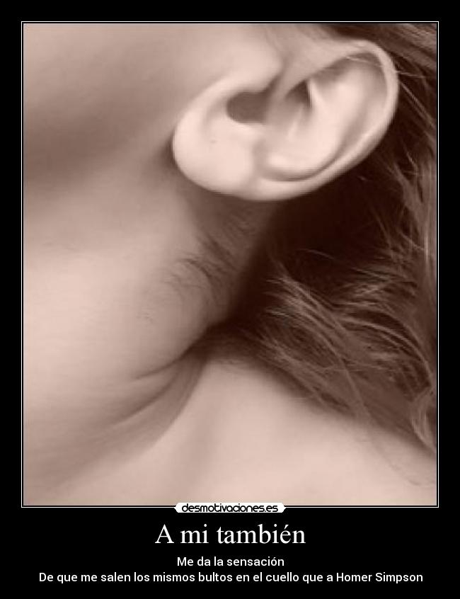A mi también - Me da la sensación
De que me salen los mismos bultos en el cuello que a Homer Simpson