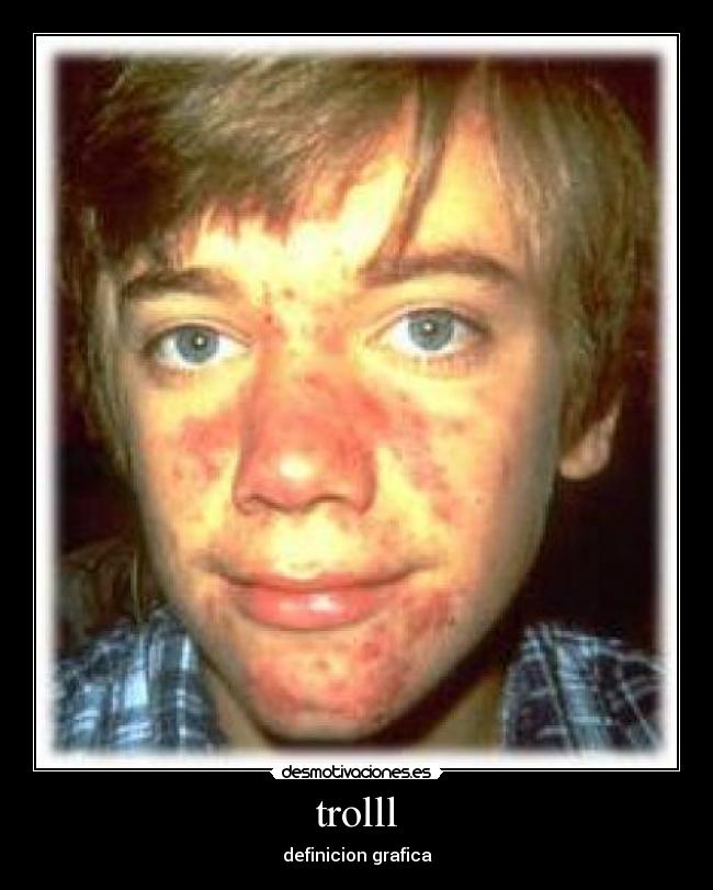 trolll - 
