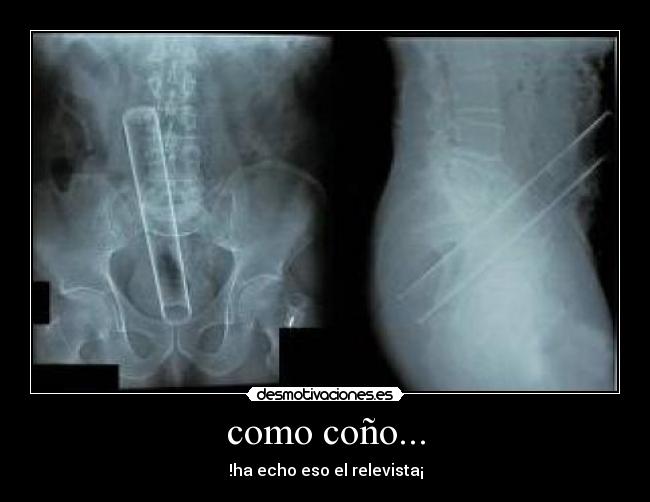 como coño... -