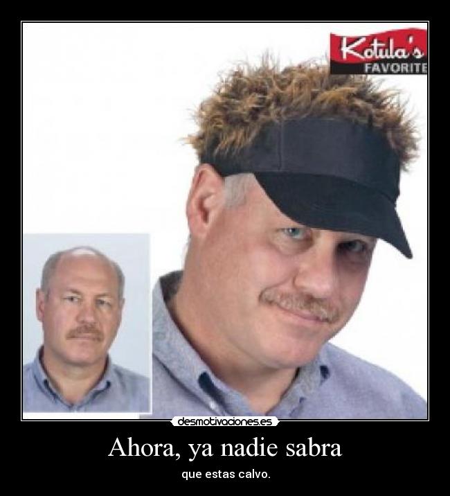 Ahora, ya nadie sabra - que estas calvo.