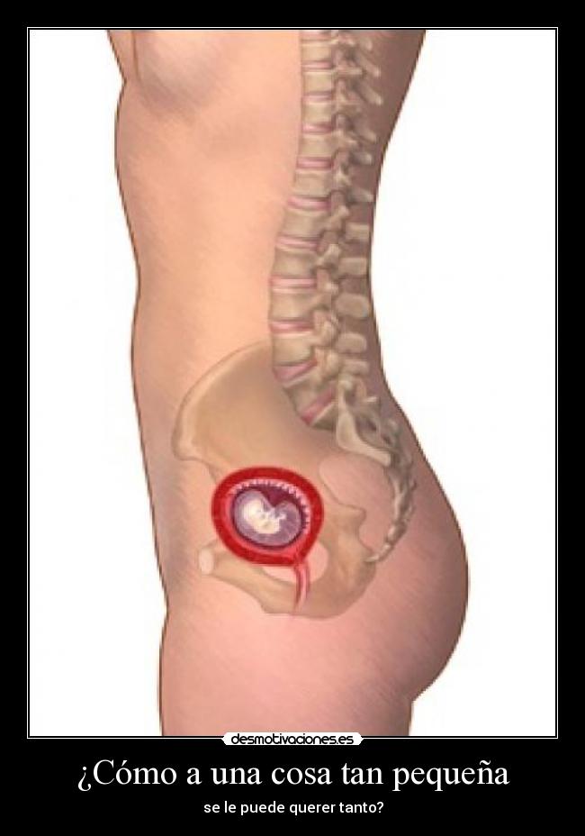 carteles dghj desmotivaciones