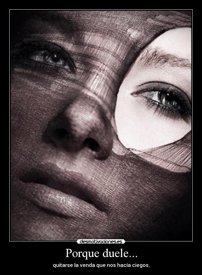 Porque duele... -