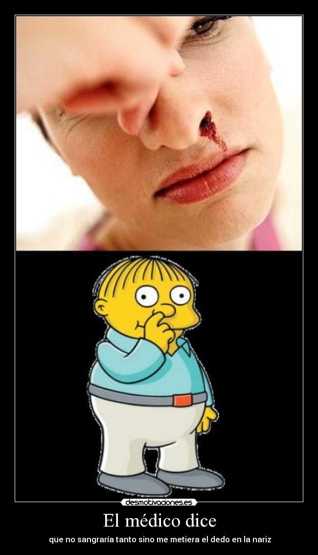 El médico dice -  que no sangraría tanto sino me metiera el dedo en la nariz
