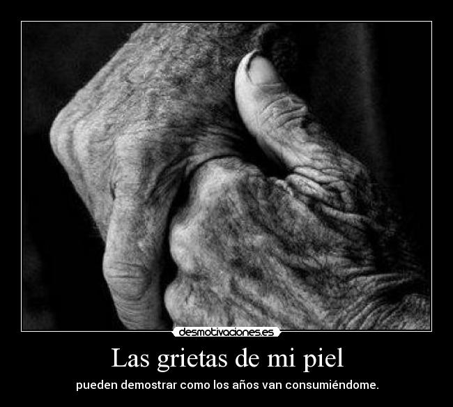 Las grietas de mi piel -