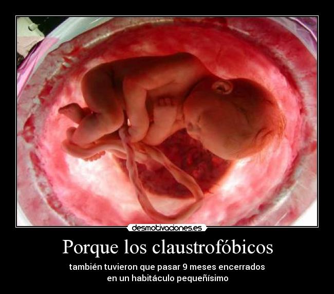 Porque los claustrofóbicos - también tuvieron que pasar 9 meses encerrados
en un habitáculo pequeñísimo