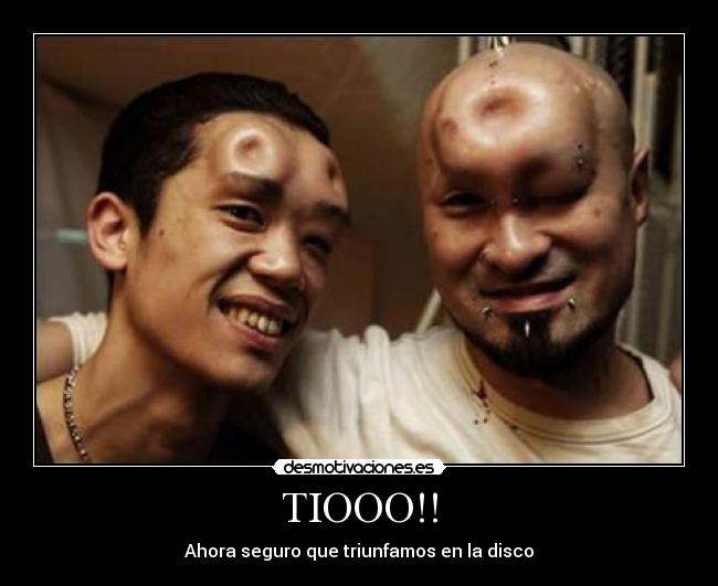 TIOOO!! -