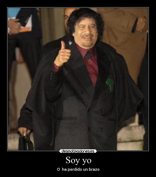 Soy yo - O  ha perdido un brazo