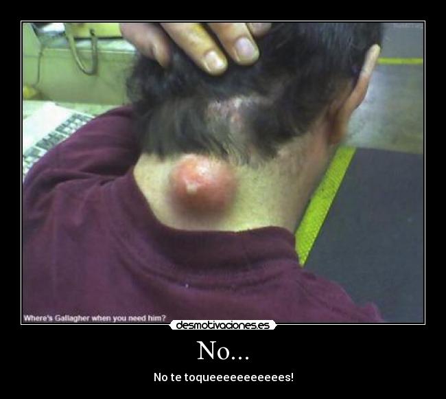 No... - No te toqueeeeeeeeeees!