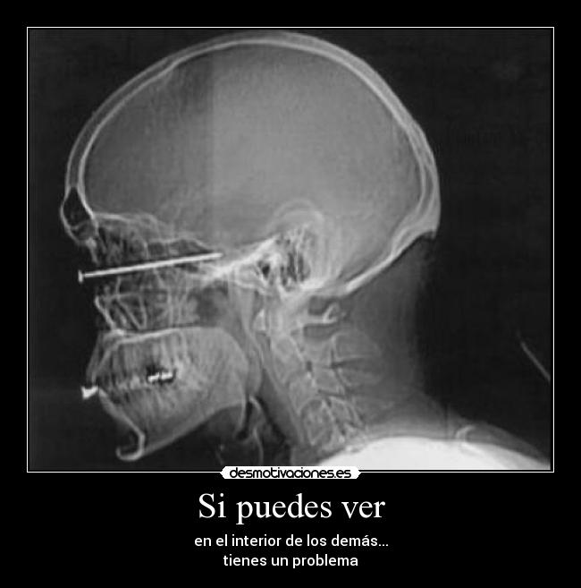 Si puedes ver - en el interior de los demás...
tienes un problema